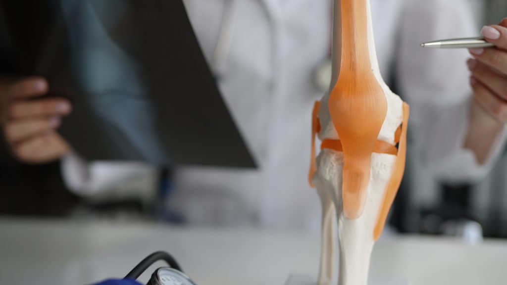 sentadillas para la rodilla